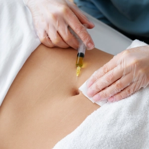 Maria Baeza Medicina Estetica Tratamiento de Mesoterapia Corporal medicina estética en Madrid, botox en Aluche, ácido hialurónico Madrid, rejuvenecimiento facial, estética avanzada.